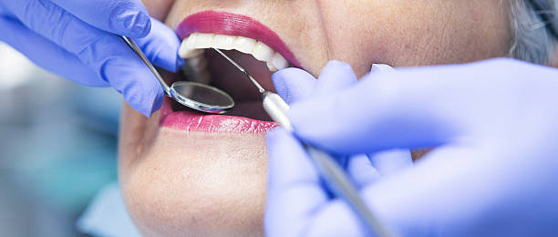 Best Emergency Wisdom Teeth Removal in Tioga Terrace, NY
